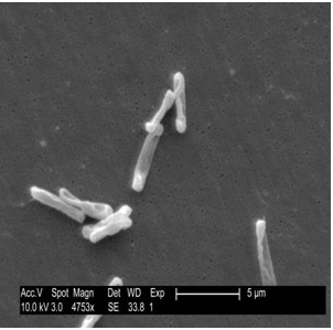 An electron microscope view of Clostridium perfingens.  Nine rod shaped objects. A scale shows that each object is no more than 5 micrometers long and less than 1 micrometer wide.