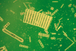 diatom (plant-like)