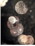 microscopic picture of foraminifera